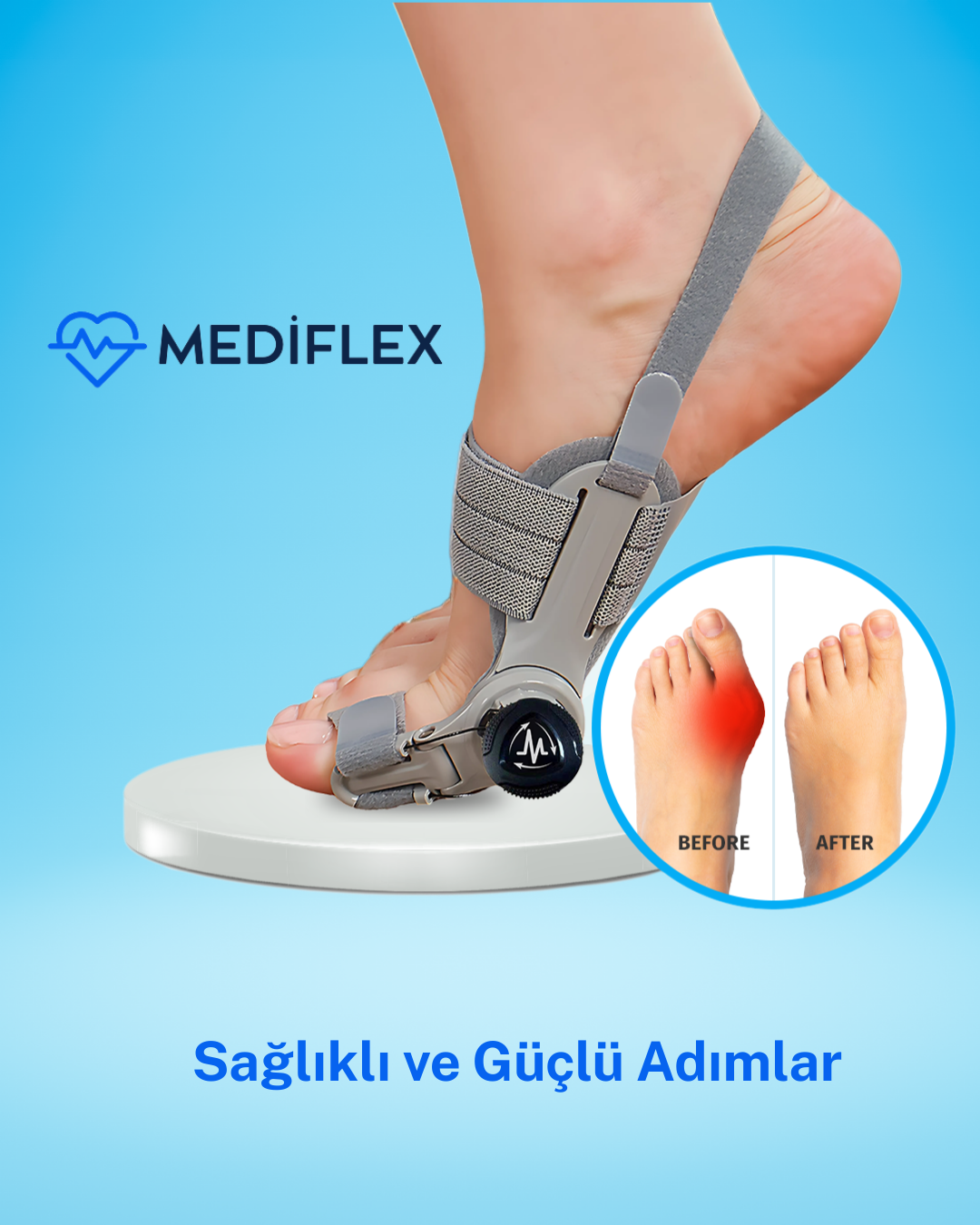 Ayak Baş Parmak Kemik Düzeltici